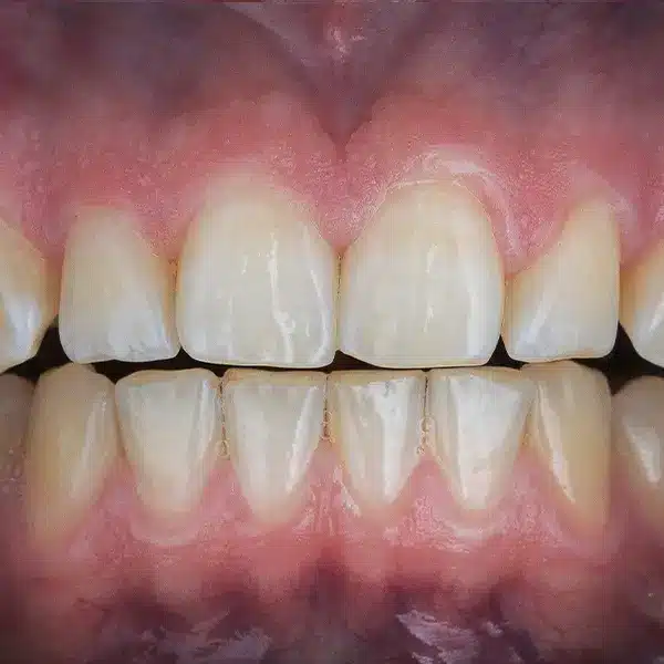 Patient teeth photo before dental procedure